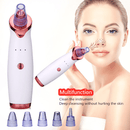 Derma Suction & Black Head Remover - smartishTrend